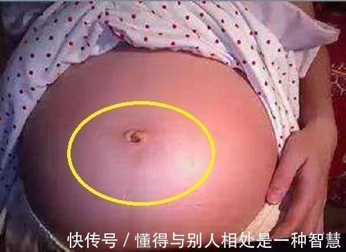 肚子|孕妈的肚脐,凸出来好还是凹进去好如果是这种状况说明很有福气
