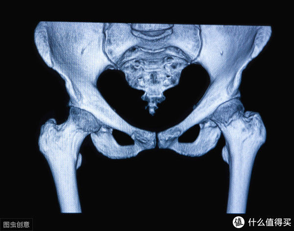 小腹|腰痛?小腹突出?你是否真的需要担心骨盆前倾?