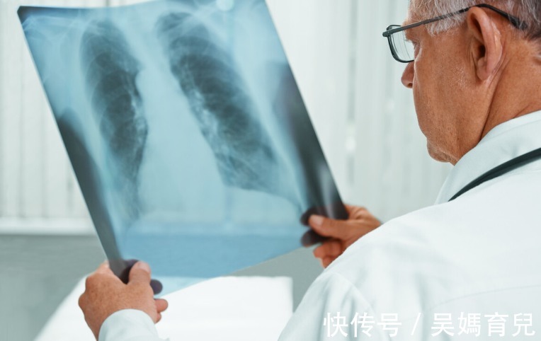 切除|体检结果显示有肺结节，严重吗？确诊肺结节，要马上切除吗？