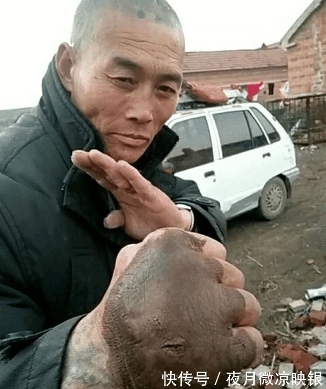 中华！男子苦练铁砂掌三十年如一日, 神功大成, 手却变成这样！