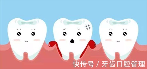 龋齿|最全牙齿护理表，牙齿护理是一辈子的事情