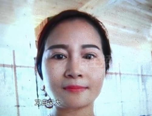 吸脂 为了让脸变尖一点 女子接受免费脸部吸脂手术 现在哭着想变回来