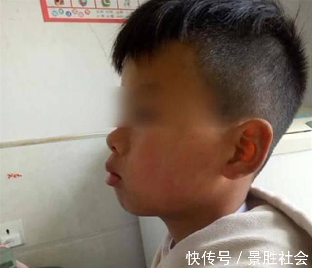 儿子|儿子越长越像“大猩猩”,宝妈调侃长残了,朋友提醒才去医院检查