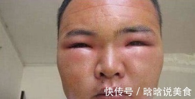 杨桃|尿毒症多是“吃”出来的建议大家4种食物少碰,肾也会感谢你!