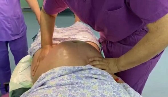 孩子|孩子臀位也能顺产？医生的这个操作亮了