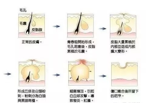 皮肤过敏|各种类型肌肤缺水的自我诊断及应对方法,你知道多少?