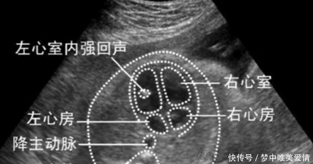 畸形|做四维彩超说胎儿正常,出生后检查出有畸形,医院有责任吗?