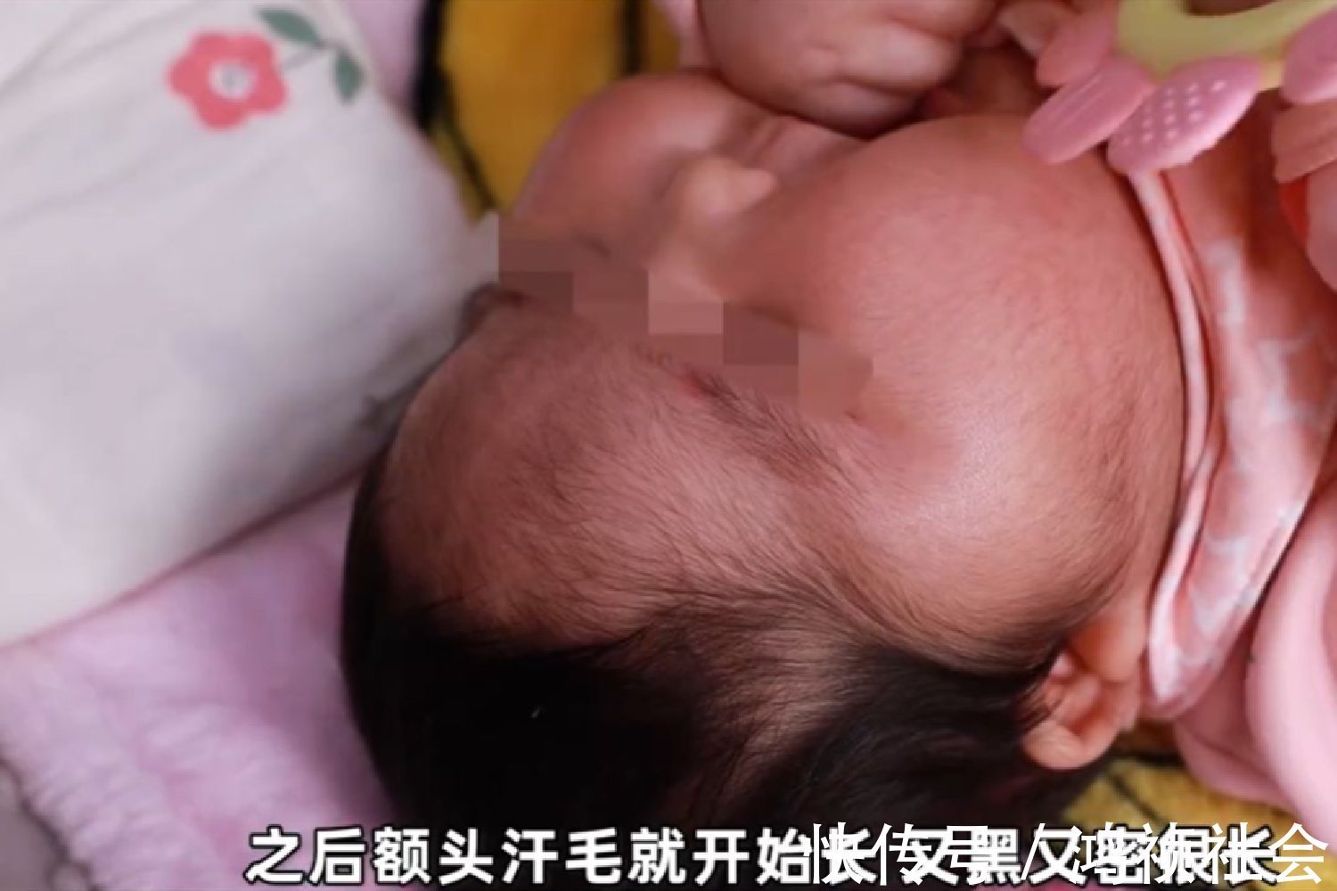 氯倍他索丙酸酯|“大头娃娃”再现,抑菌霜激素超标,致5个月女婴疯狂长胖长毛