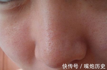 毛孔|毛孔粗大注意了,每天用它敷面膜,半个月轻松收缩毛孔