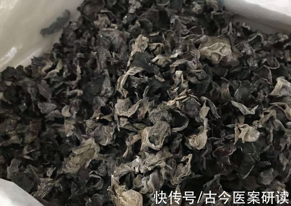 木耳|无缘无故患上白血病?这4种平民食物,或许你经常吃
