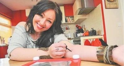 荨麻疹|他们患上荨麻疹后变身为“画家”