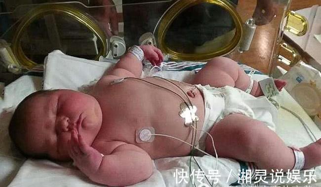 巨婴|怀孕9月感觉肚子里的不是婴儿,去医院剖腹产,取出以后全场安静