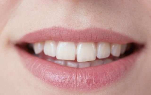 女性|女性出现妇科病,嘴巴会提前知晓,没有3种情况,说明身体很健康