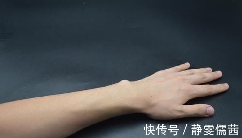 妙招|皮肤晒黑了怎么办?试试这个小妙招,皮肤更白更嫩滑,都看看吧