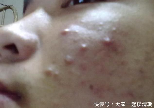 有这“3个坏习惯”的女生,颜值会越来越低,赶紧改了吧