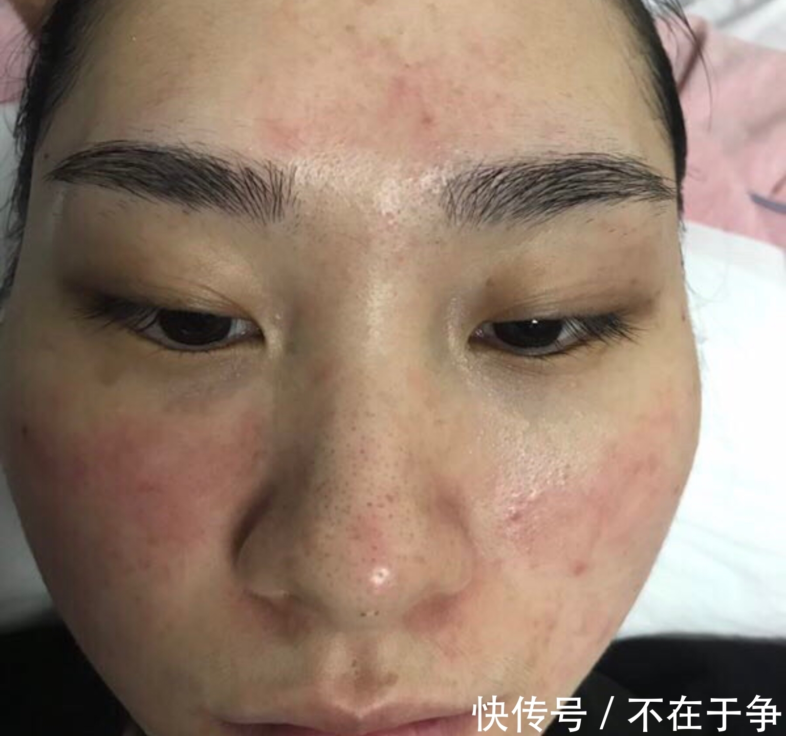 倩碧黄油 护肤品“混搭”会怎样?你只知其一不知其二,这些现象你有几个!