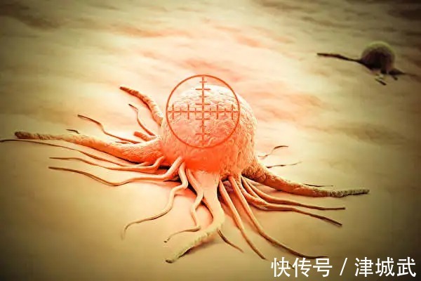 化疗|仅需120万,CAR-T疗法两个月能治愈癌症,但是!有几个人能给得起?