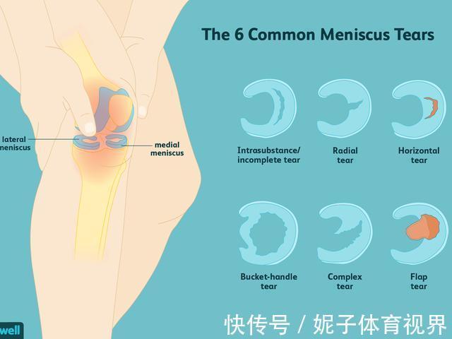 患者|膝盖疼,就是得滑膜炎了?医生辟谣,教您一步步判断自己的病因