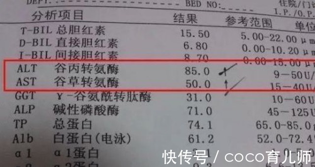 医生|转氨酶升高是肝脏不好吗?医生提醒:几个原因不容忽视