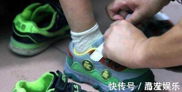 孩子|6岁宝宝双脚“变形”只因常年穿“这种鞋”，父母要重视起来