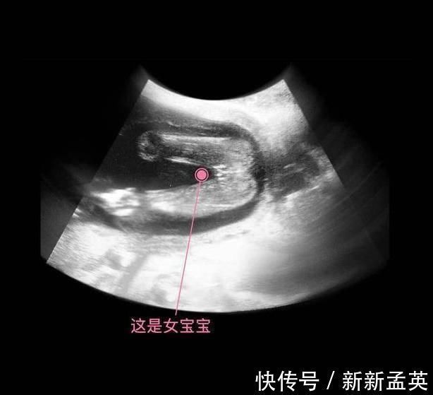 胚胎|胎儿从卵泡到性别形成,17张图片清晰诠释,男宝女宝看得很清楚