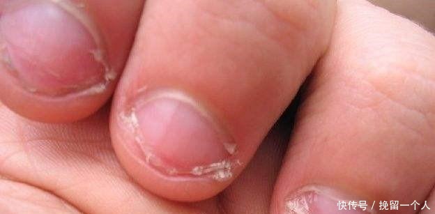 食物|提醒家长6个信号说明小孩缺锌了,不重视会影响智力发育!