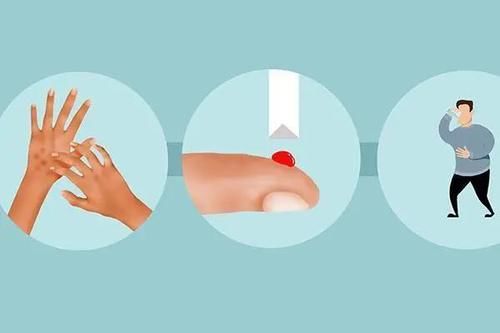 高血糖十年，双腿长期麻木，寒凉，应如何缓解？医生和您聊聊