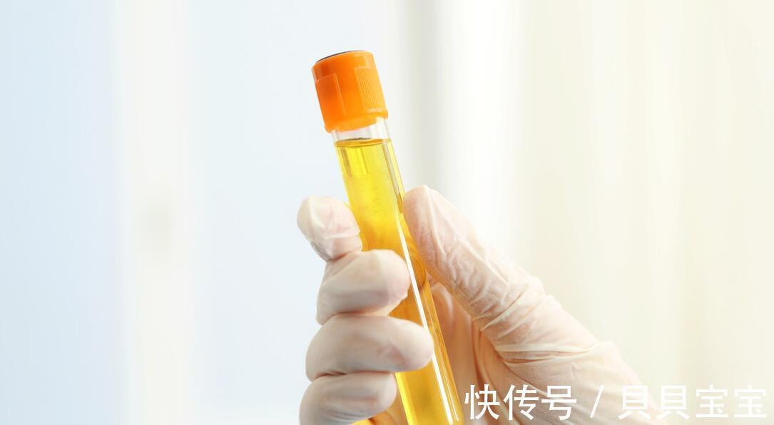 病理|尿蛋白对肾脏的伤害有多大?控制不好的病友,大半进展到了尿毒症