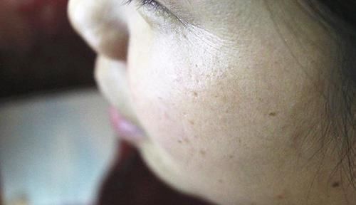 绝经|为啥女人进入更年期后,都会变“丑”?教你三招,或能重返年轻