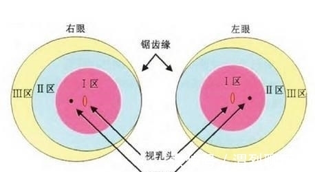 早产儿|早产儿眼底筛查必须做吗？有问题应怎样治疗？