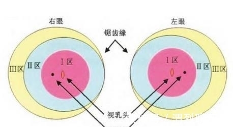 早产儿|早产儿眼底筛查必须做吗?有问题应怎样治疗?
