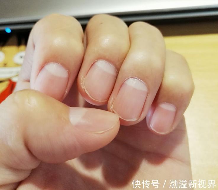 指甲|指甲上没有月牙与指甲上有的人,谁身体更健康科学的解释来了