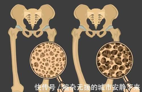 月经紊乱|女性绝经的年龄在44至54岁之间,绝经前的5个表现,需仔细观察