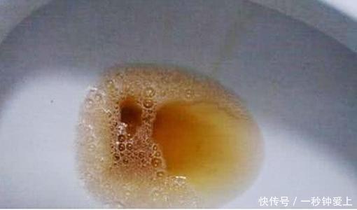 豆奶|早上是养肝的黄金时间,多吃4种食物,肝脏会更健康