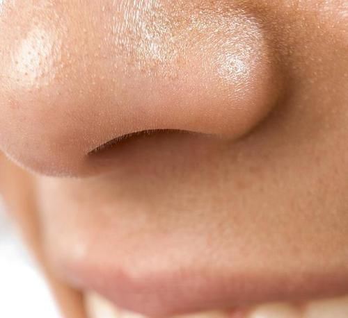 鼻翼|鼻翼侧边能挤出的白色分泌物,到底是什么,别在用手挤了