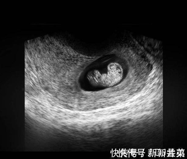 羊水|胎儿从卵泡到性别形成,17张图片清晰诠释,男宝女宝看得很清楚