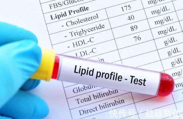 高血脂|降血脂“高手”终被找到,不是木耳,若你爱吃,血管干净又年轻!