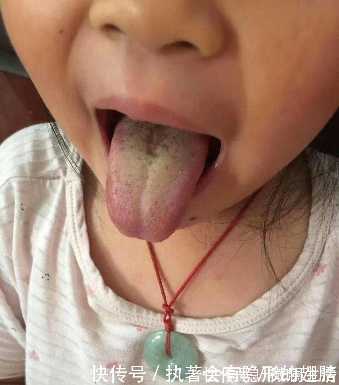 柳果刺锌|儿科主任:1种食物敞开吃,纯天然消积健脾,宝宝少积食、胃口好!