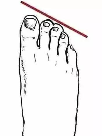 美女脚 你的脚型穿对了鞋吗希腊脚是公认的美女脚,很多人是埃及脚