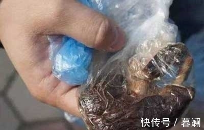 剧痛|剖腹产生下儿子后，腹部剧痛难忍，医生再次打开肚子，吓得傻了眼