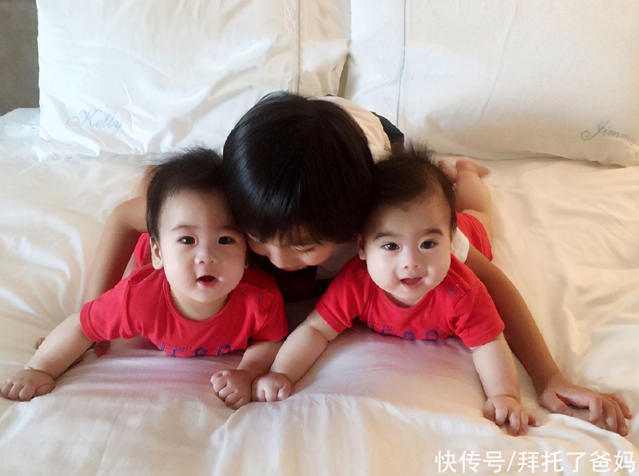 多胞胎|为什么现在的年轻夫妇,动不动就生“双胞胎”?医生:不是偶然