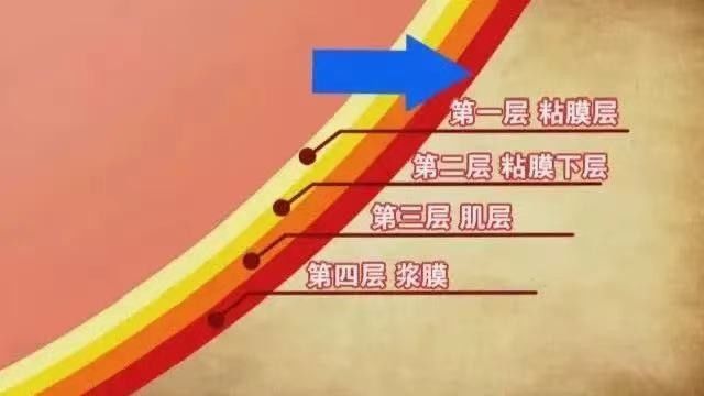 胃病|胃病无小事，一不小心可能拖成癌！有这些迹象要及时就诊