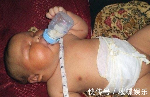 产妇|41岁高龄产妇竟产下17斤巨婴, 巨宝宝胃口更是大得让人咂舌