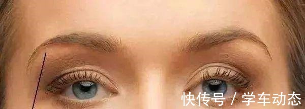 眉骨处 医美避坑理性变美,五大理由拒绝假体眉弓骨!