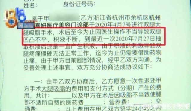 手术|女子做大腿吸脂手术，术后腿部有积液，跑了40多趟抽积液