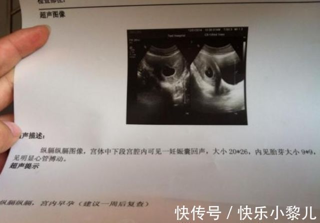 怀孕|准妈妈怀孕13周才告诉丈夫,打乱浪漫计划,怀孕不要瞒着哪些人?