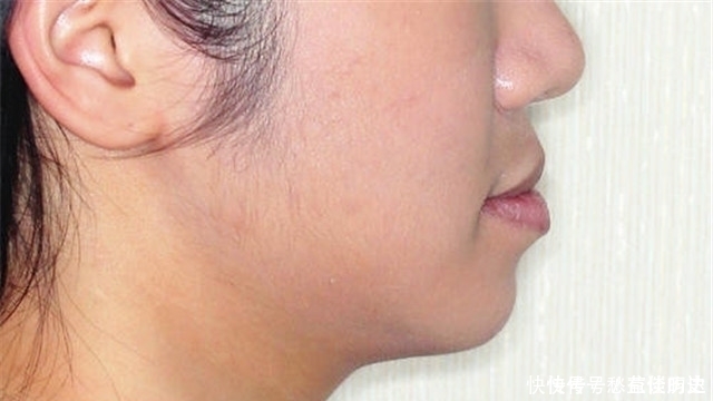 公认最丑的4种女生“唇形”，严重拉低颜值，我中了第2个，你呢？