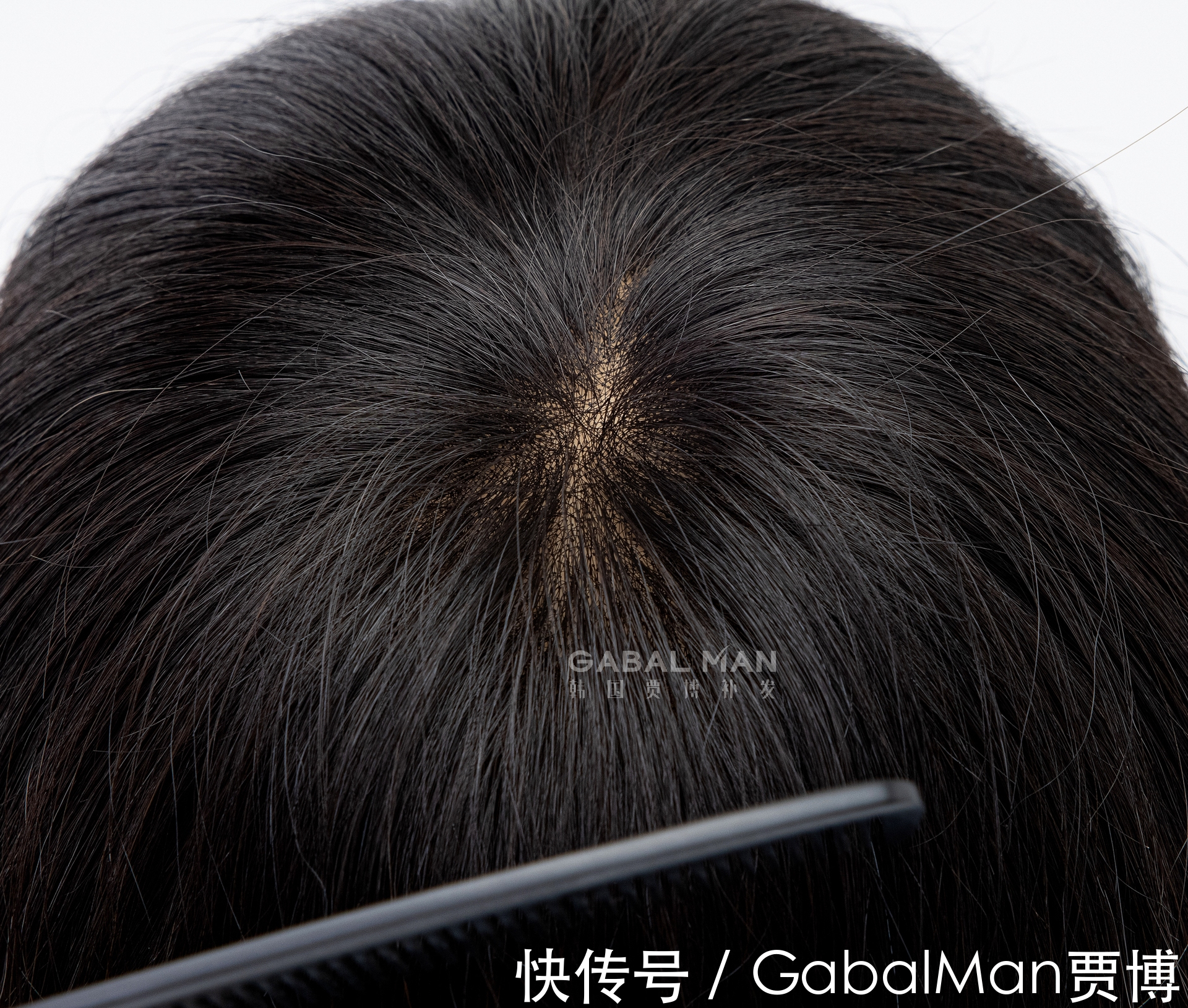 秃头|秃头再也不怕被嘲笑了!用了这个神器,颜值提升2倍