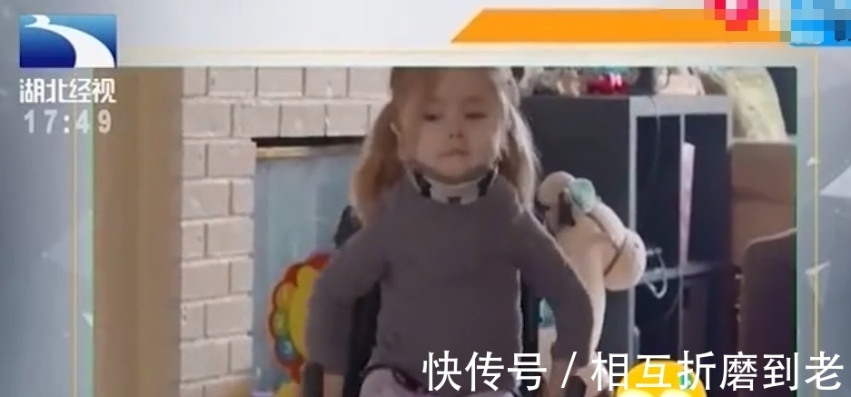 脆弱|最“脆弱”的女孩:1年骨折100多次,打个喷嚏都会骨折