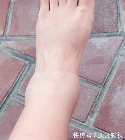 环球影城|红果果产后8天发文,曝因孕期贪玩儿子早产,提醒孕妈要听医生话